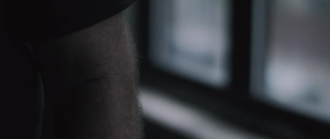 The area from a person's shoulder down the arm is shown in a room during the day