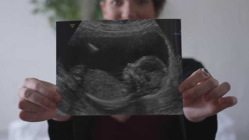 A woman smiles as she holds up an ultrasound image