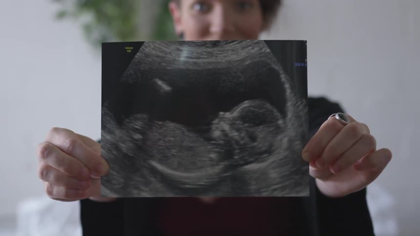 Mom holds up ultrasound of baby