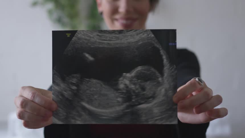 A pregnant woman smiles big as she holds up a sonogram of her baby