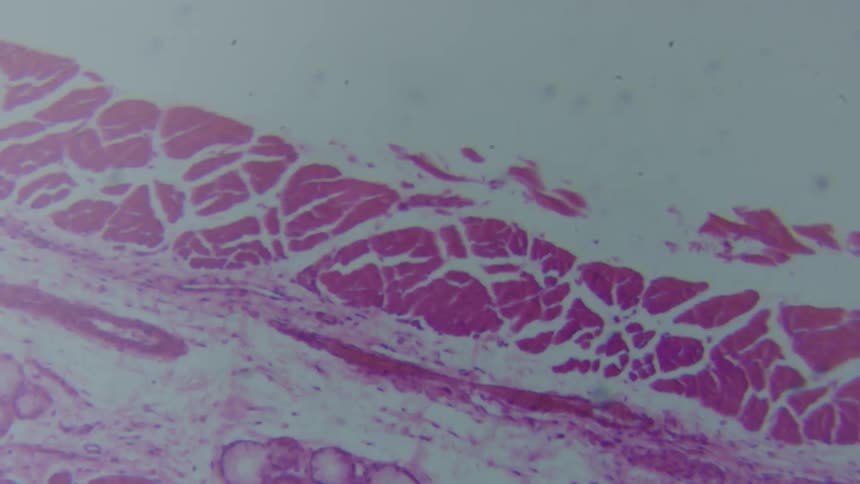 Pink splashes on white