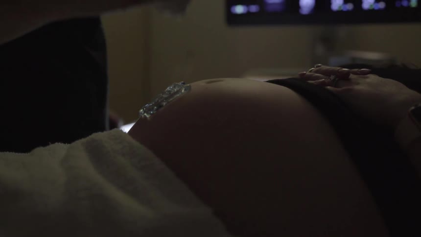 A person squeezes lubrication gel onto a pregnant woman's stomach