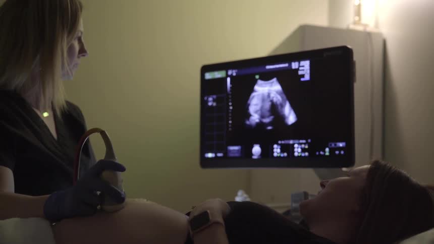 A pregnant woman gets an ultrasound reading of her womb by a midwife