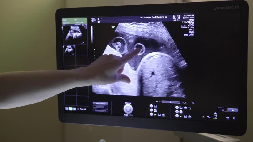 A person pointing at an ultrasound on a screen