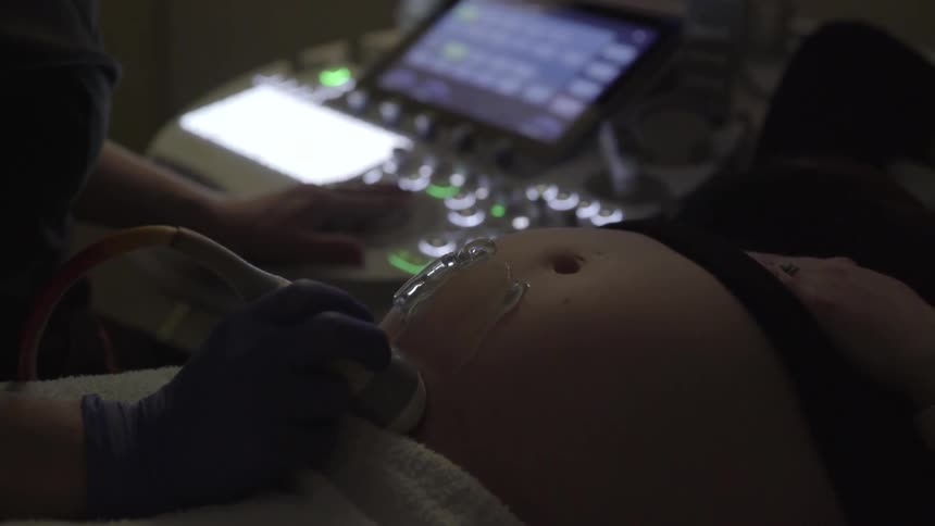 A nurse conducts an ultrasound on a pregnant woman