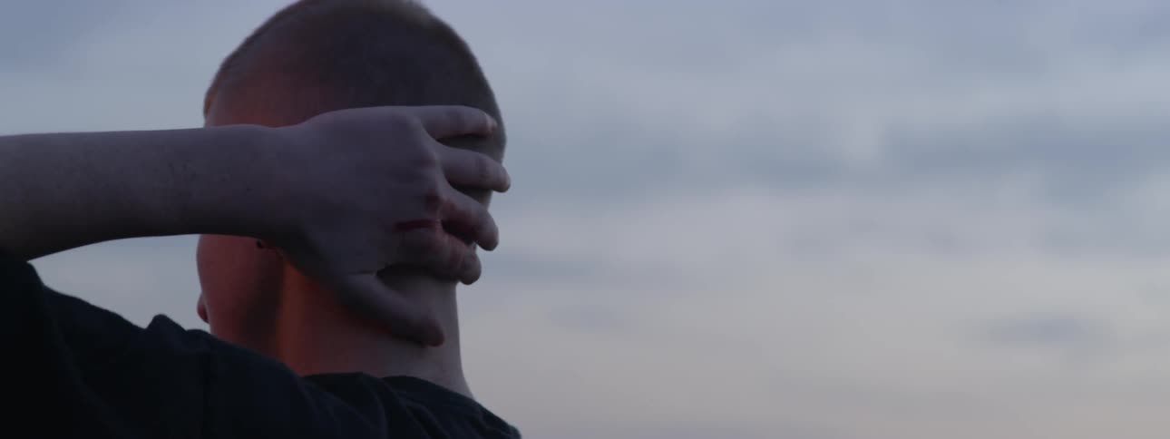 A man rubs his hand with bloody knuckles on his head