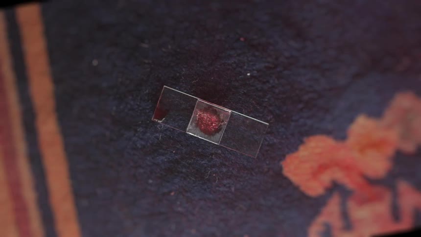 A red organism or virus rapidly grows on a microscope slide