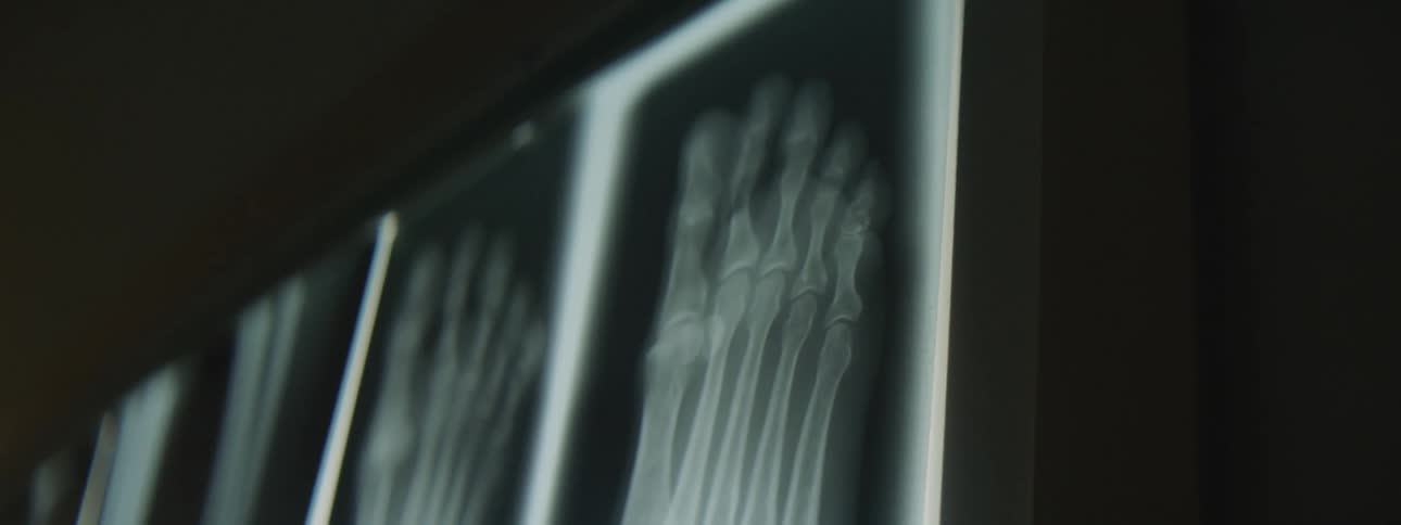 X rays up on a screen