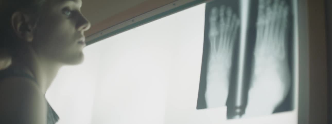 A young woman using crutches tearing down x ray images of her foot
