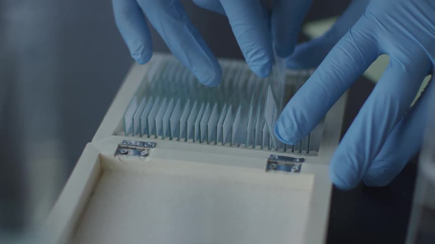 A person wearing latex gloves storing a slide in a special box