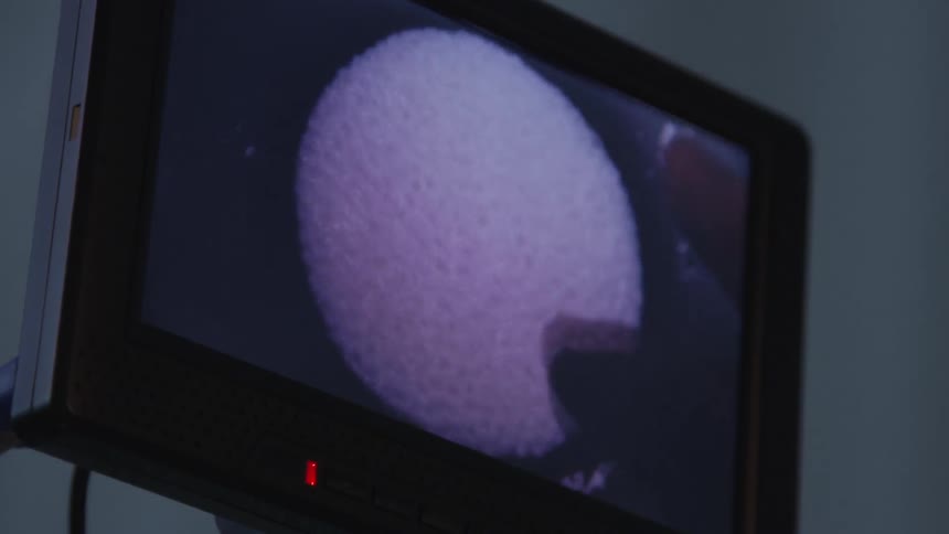 A person touches a white substance as seen on a monitor