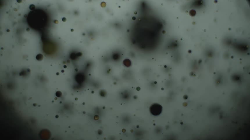 A microscopic view of bacteria