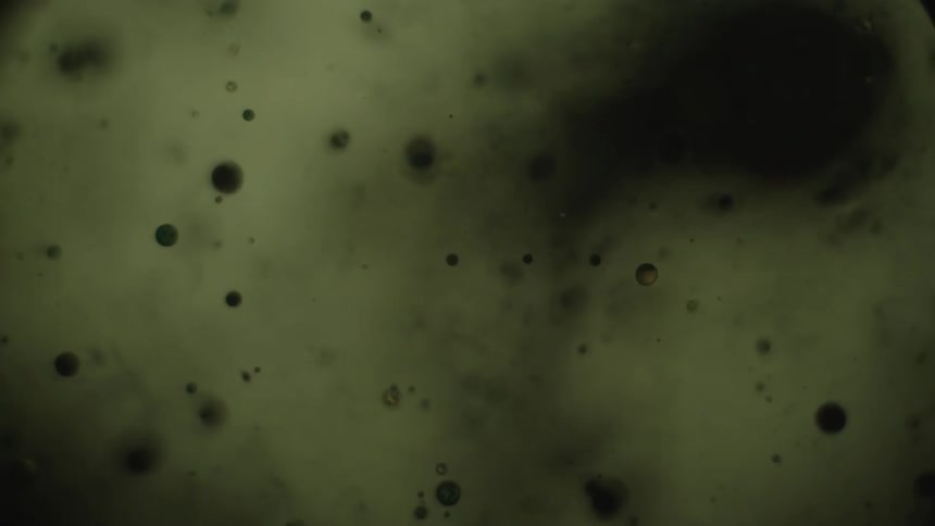 Dark spots in a liquid in and out of focus